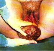 bebek doğum anı