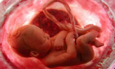 Gebelikte Kan Uyuşmazlığı