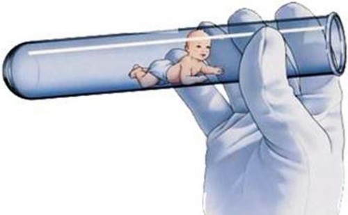 TÜP BEBEK İŞLEMLERİ VE FİYATI