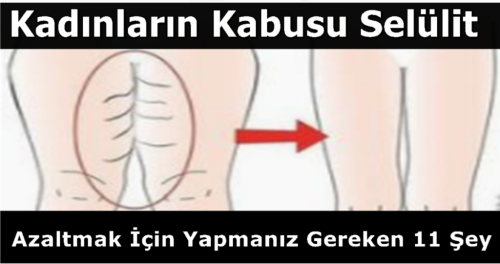 Selülit Kâbusu