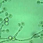 Candida