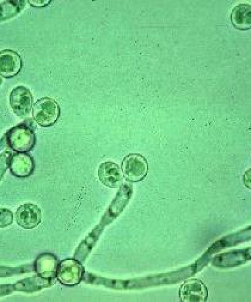 Candida