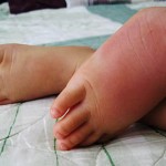 BÖCEK SOKMALARINDA ÇEŞİTLİ TEHLİKE DURUMLARI