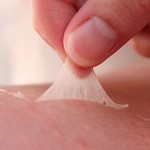 GÜNEŞ YANIĞI BELİRTİLERİ VE TEDAVİSİ