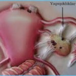 YAPIŞIKLAR