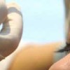 Botoks ( Botox) Nedir?