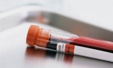 Hamilelik Öncesi Yaptırmanız Gereken Testler