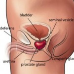 Kırk Yaşından Sonra Prostat’dan Kaçış Yok