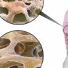 Osteoporoz Nasıl Olur?