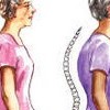 Osteoporozdan Korunma