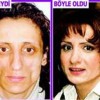 Estetik ameliyatlar ve fiyatları