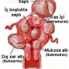 Myom ameliyatı olurken belden uyuşturdular...