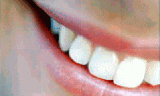 Evde diş beyazlatma yöntemleri
