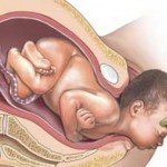Doğum Anında Bebeğin Geliş Şekli Pozisyon ve Şekli Nasıl Olacak?