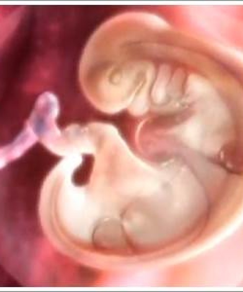 Gebeliğin 2. Ayında Anne Karnında Bebek Ne Durumdadır
