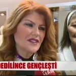Evlilik Programında Reddedildi, Estetik Ameliyatla Bakın Ne Hale Geldi