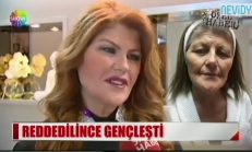 Evlilik Programında Reddedildi, Estetik Ameliyatla Bakın Ne Hale Geldi