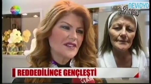 Evlilik Programında Reddedildi, Estetik Ameliyatla Bakın Ne Hale Geldi