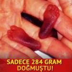 Dünyanın En Küçük Prematüre Bebeğiydi Büyüdü… İşte Şimdiki Hali