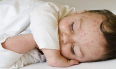 Oğlumun Bu Listedeki Yiyeceklere Alerjisi Varmış Listedeki -1 ve +3 Ne Anlama Geliyor