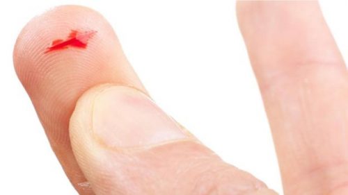 Küçük Yaralanmalarda Oluşan Kanamayı Bu Baharatla Durdurun