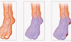 Bir Türlü Isınamayan Soğuk El ve Ayaklar İçin Çözüm Önerileri