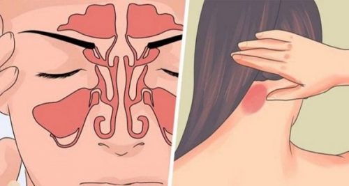 Erken Uyarı! Diyabet Belirtileri Kendinizin Doktoru Olun Erken Önlem Hayat Kurtarır