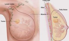 Bu Vitamin Kanserin Büyümesini Durduruyor! Sağlığınızı İhmal Etmeyin