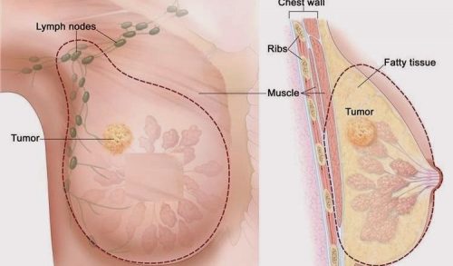 Bu Vitamin Kanserin Büyümesini Durduruyor! Sağlığınızı İhmal Etmeyin