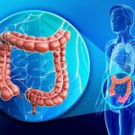 Zencefil Prostat ve Kolon Kanserini Yok Ediyor! Kemoterapiden Daha İyi ve Sağlıklı