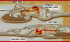 Reflü ve Gastrit Sorunu Olanlar Gece Yatarken Zorluk Çekenler! Sol Tarafınıza Yatın İşte Nedenleri