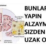 Bunları Yaparsanız Alzheimer ve Bunama Yanınıza Dahi Yaklaşamayacak