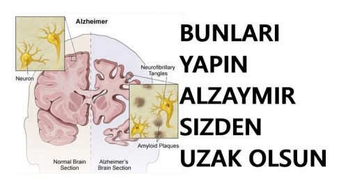 Bunları Yaparsanız Alzheimer ve Bunama Yanınıza Dahi Yaklaşamayacak