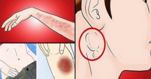 Bu 16 Belirti Kanser Habercisi Olabilir Kaçmayın Erken Teşhis Hayat Kurtarır