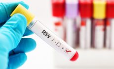 Çocuklarınızı RSV Virüsüne Karşı Koruyabiliyor Musunuz? İşte Belirtileri ve Bulaşma Yolları