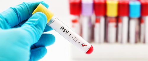 Çocuklarınızı RSV Virüsüne Karşı Koruyabiliyor Musunuz? İşte Belirtileri ve Bulaşma Yolları