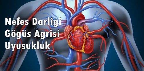 Bu 9 Yiyecek Damar Tıkanıklığınızı Giderecek Kanınız Eskisi Gibi Damarlarınızdan Şırıl Şırıl Akacak